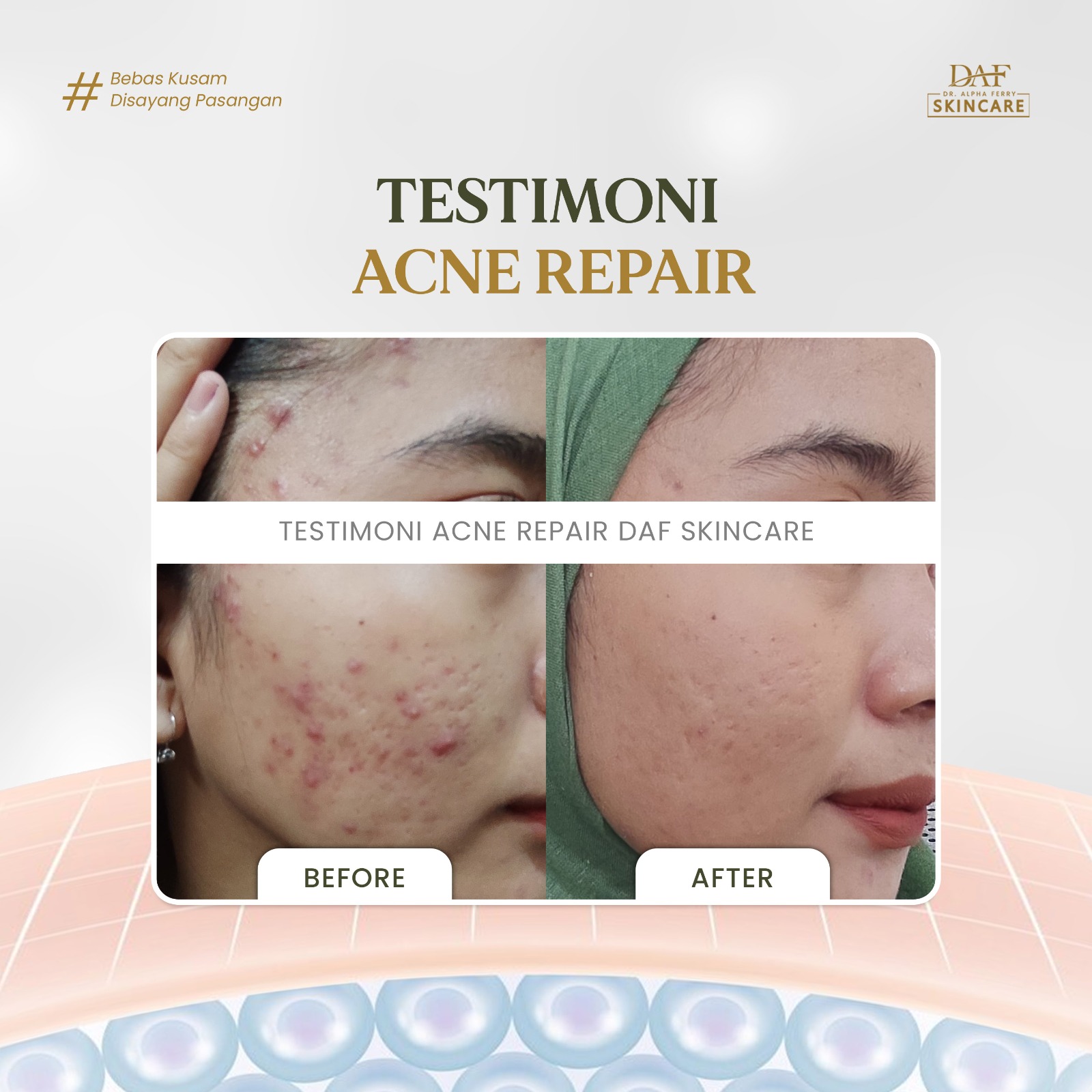 Potret Diah dengan kulit yang lembap dan segar